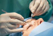 Photo of Hasta 8 años de cárcel por cirugías estéticas infantiles