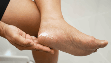 Photo of Confirman por primer caso humano de gusano barrenador en Tamaulipas